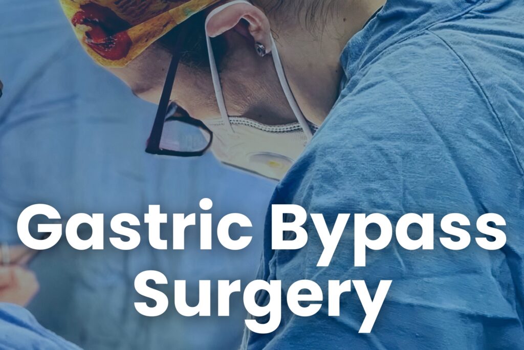 RNY Gastric Bypass Surgery in Mexico - Jacqueline Osuna